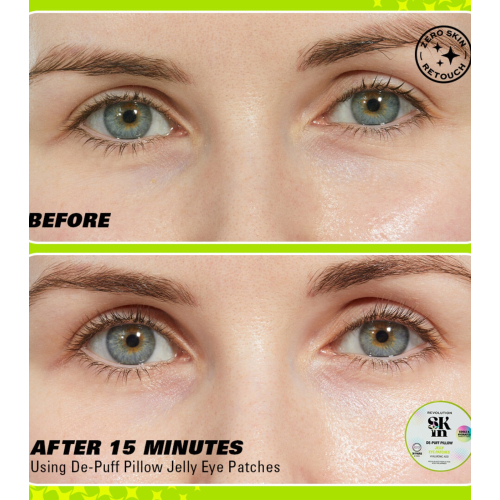 Revolution Skin - Patchs hydrogel pour les yeux à l'acide hyaluronique Jelly De-Puff Pillow