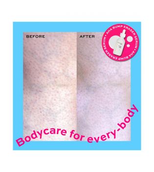 Revolution Skincare - *Body Skincare* - Sérum Corps AHA Bump Eraser