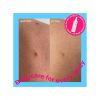 Revolution Skincare - *Body Skincare* - Spray corporel anti-imperfections