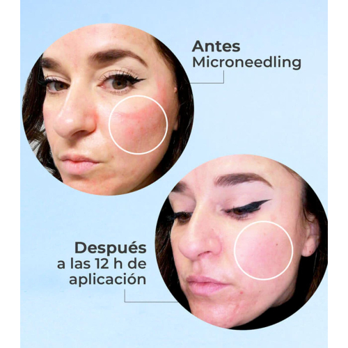 SEGLE - Sérum visage anti-âge régénérant Skin Factor - Peau sensible