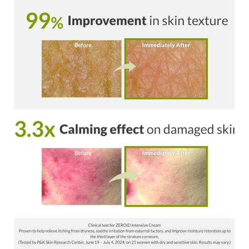 Zeroid - Crème réparatrice intensive